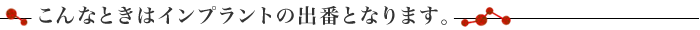 こんなときはインプラントの出番となります。
