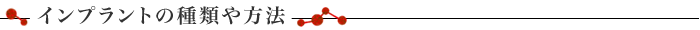 インプラントの種類や方法