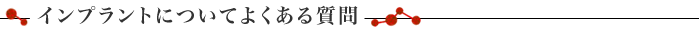 インプラントについてよくある質問